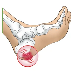 Die moderne Hausfrau Fersenspornkissen, 1 Paar Herren