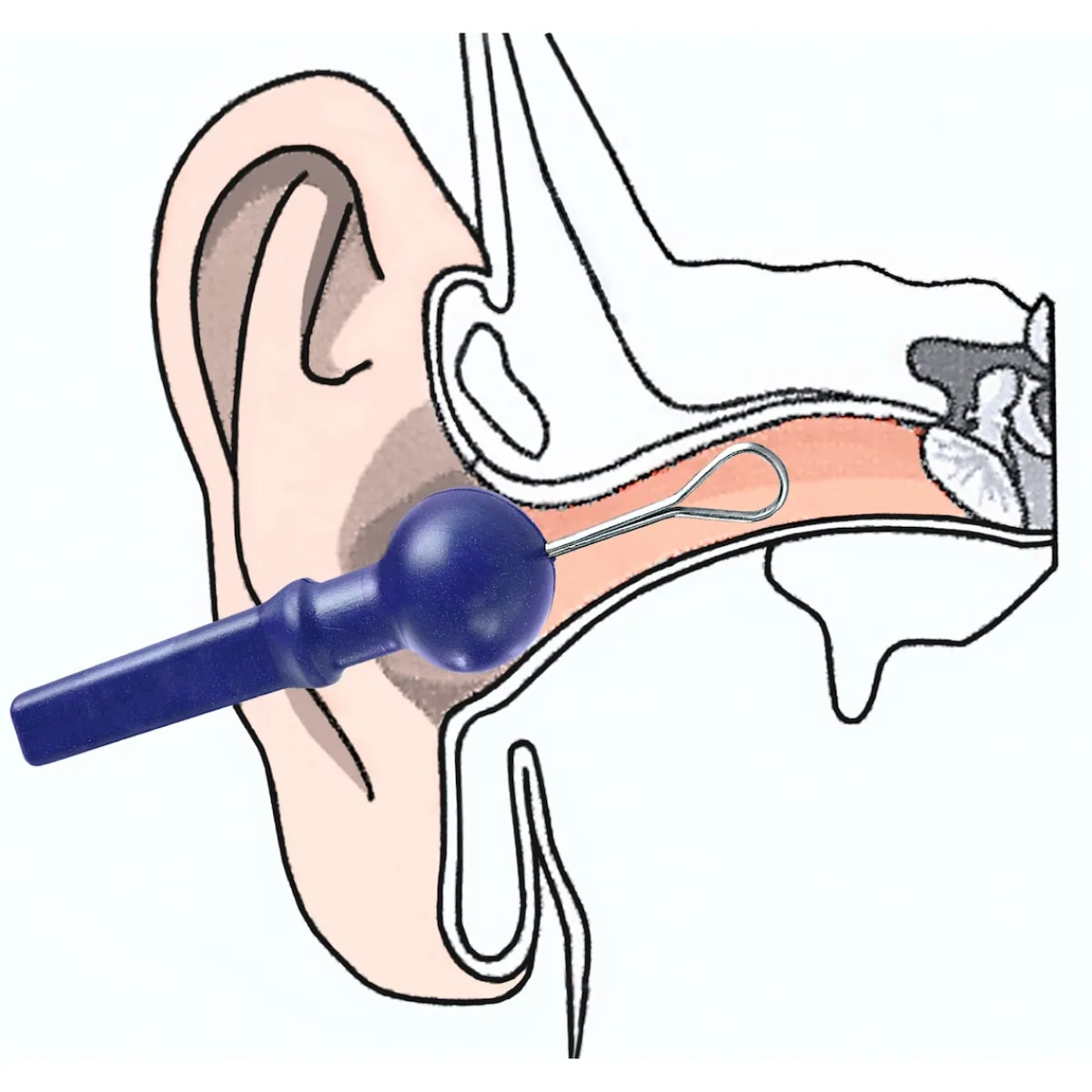 Die moderne Hausfrau Sicherheits-Ohrreiniger einzeln