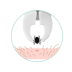 Die moderne Hausfrau Zeckengreifer tickSAFE, Tier, mit rotierendem Greiferkopf