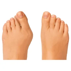 Die moderne Hausfrau Zehen-Distanz-Schiene, 2 Stück